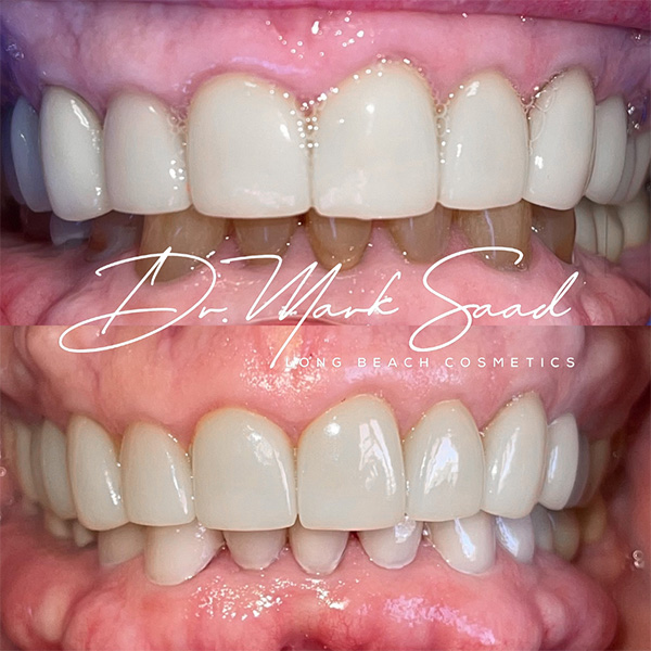 dental transformation result before after