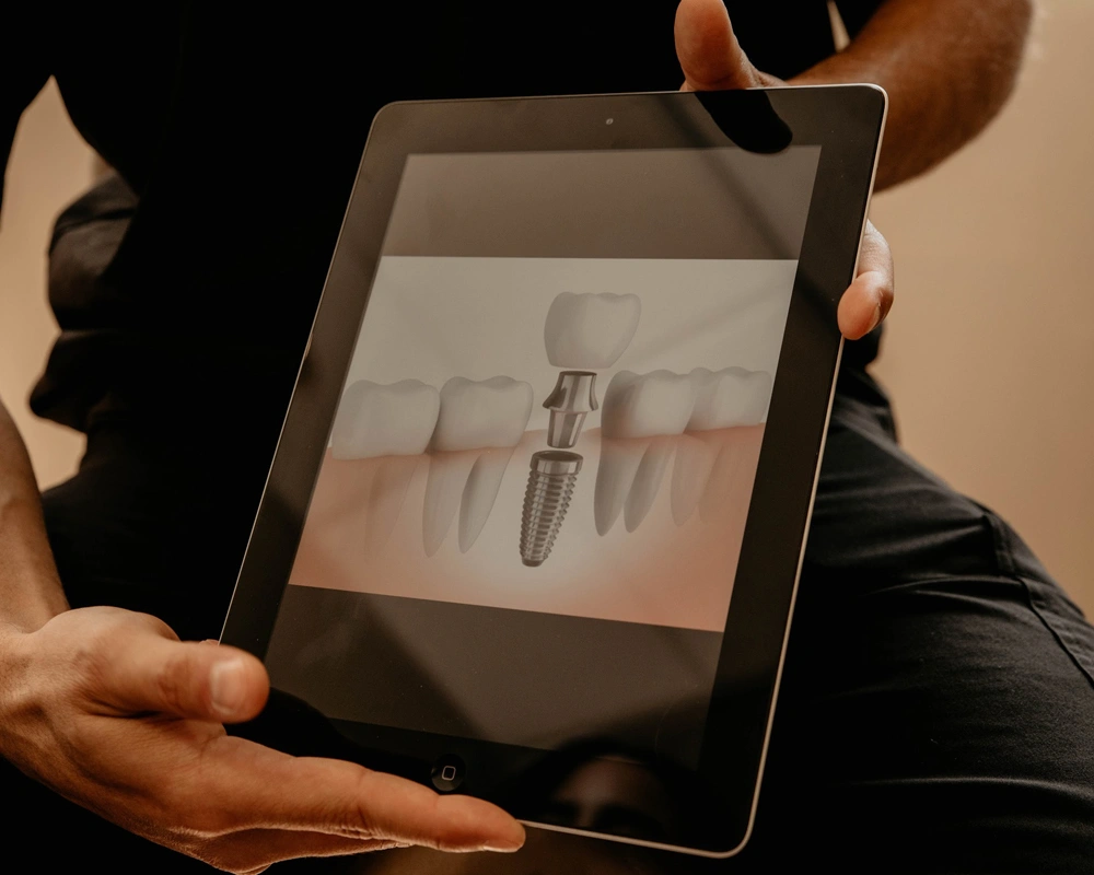 dentist showing implants to patient