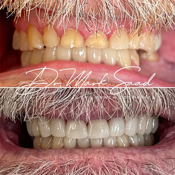smile transformation results